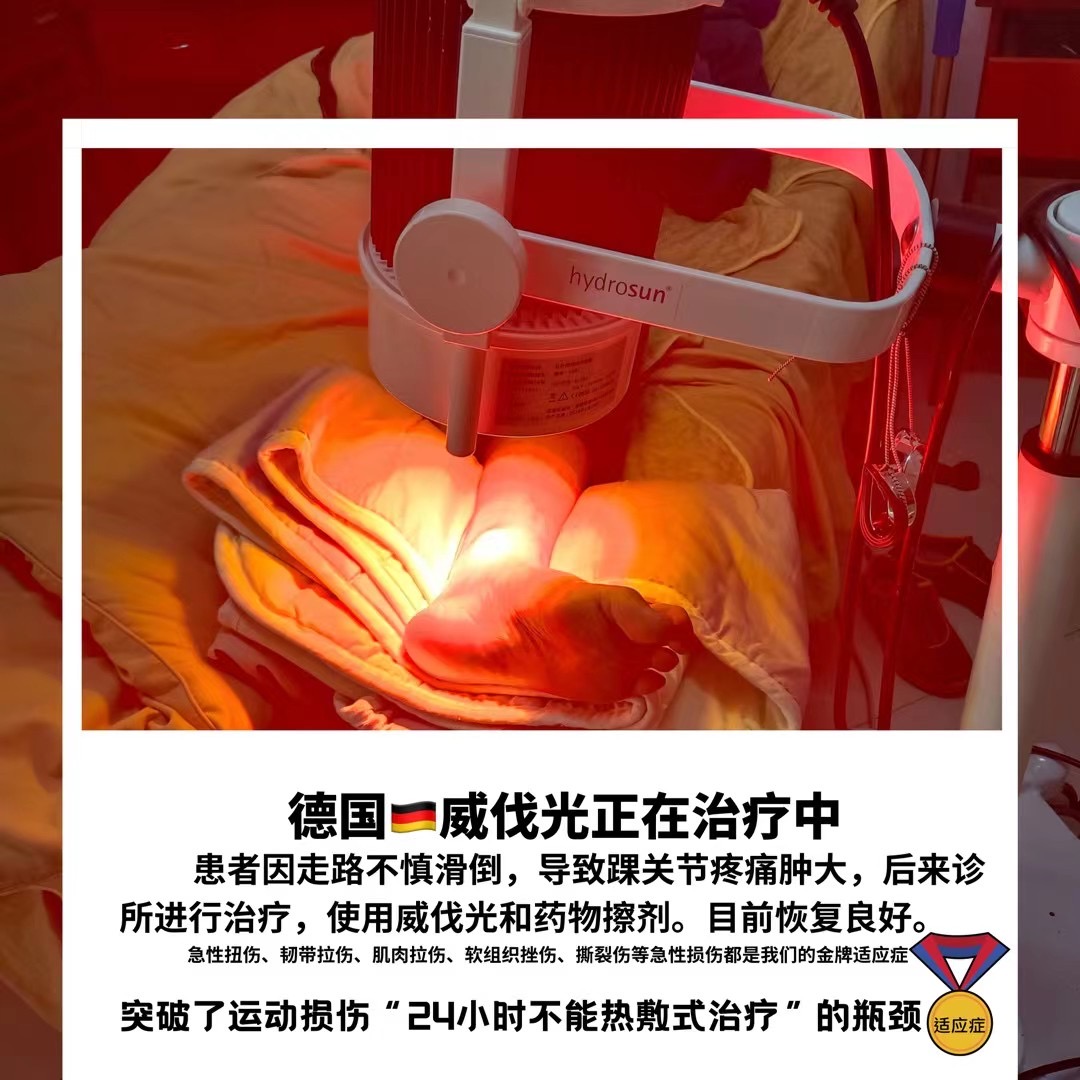 威伐光——急性扭挫傷（20211104）