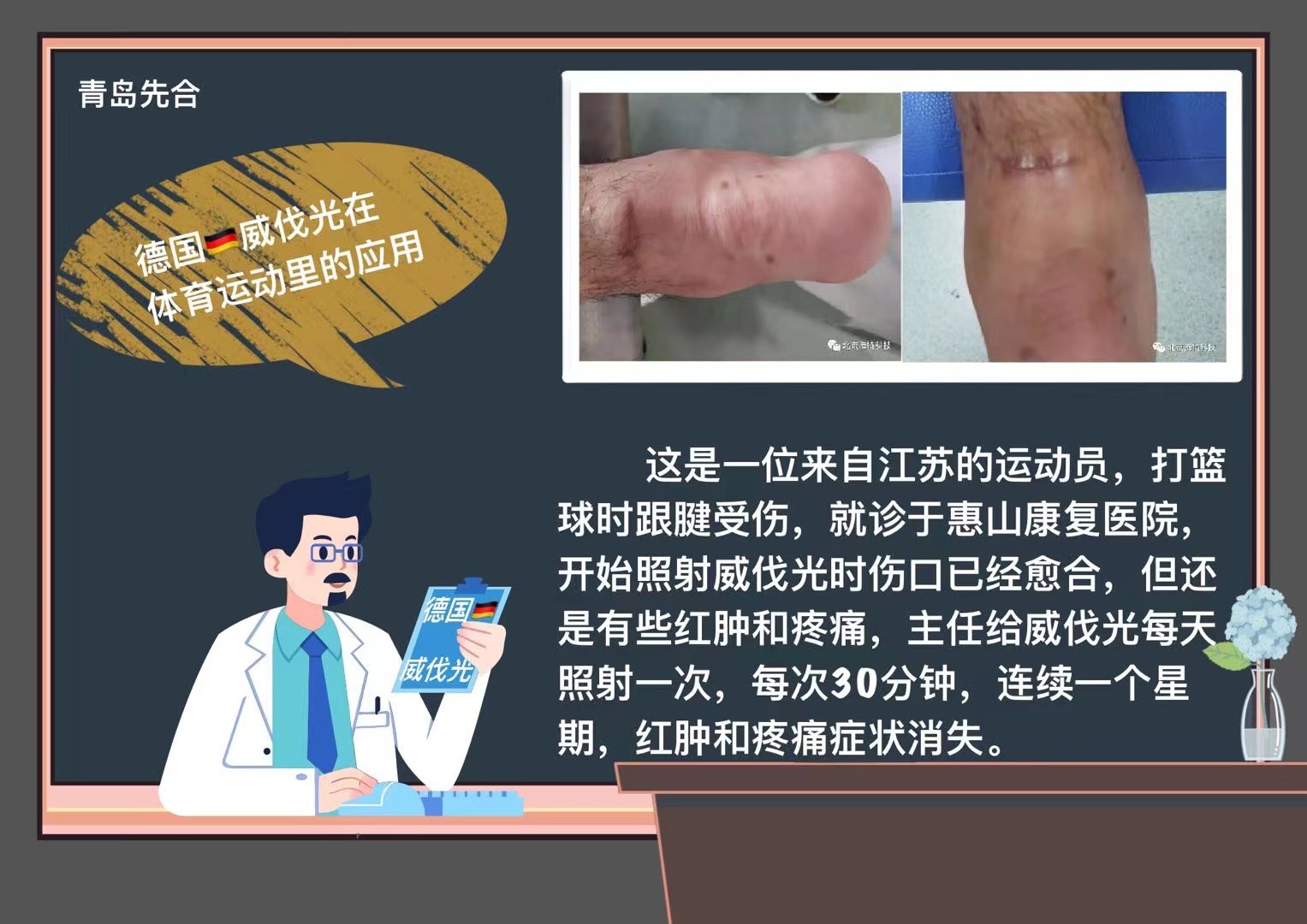 威伐光——跟腱損傷（20220124）